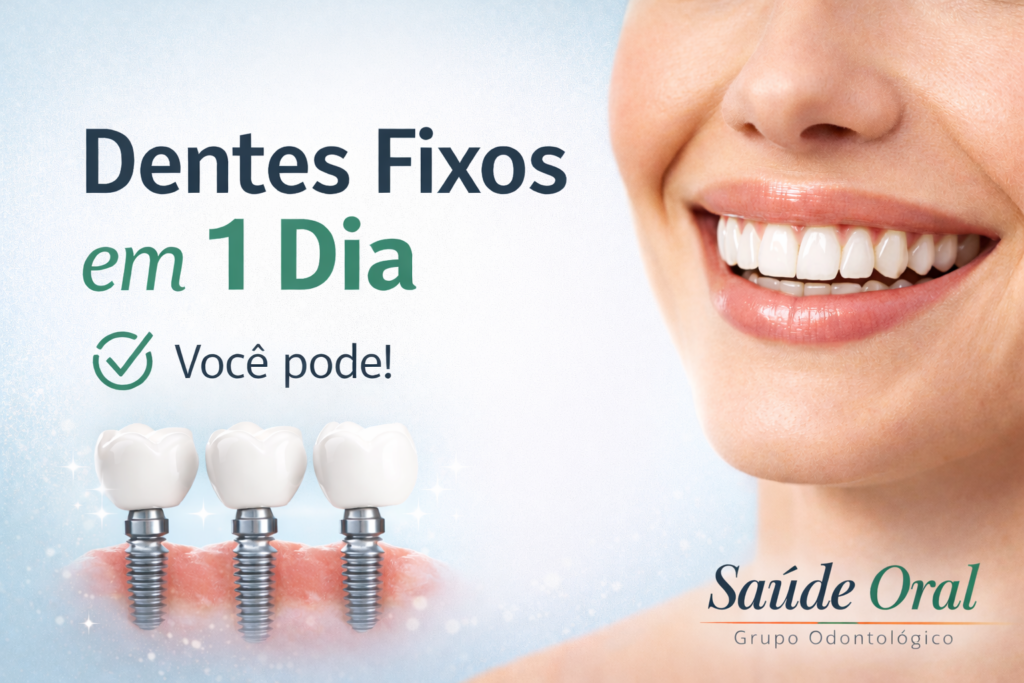 Dentes Fixos em 1 Dia: uma nova realidade para quem sofre com a dentadura